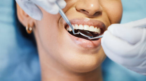 Best Emergency Dentist for Knocked-Out Tooth in Bellefontaine Neighbors, MO